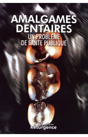 Amalgames dentaires